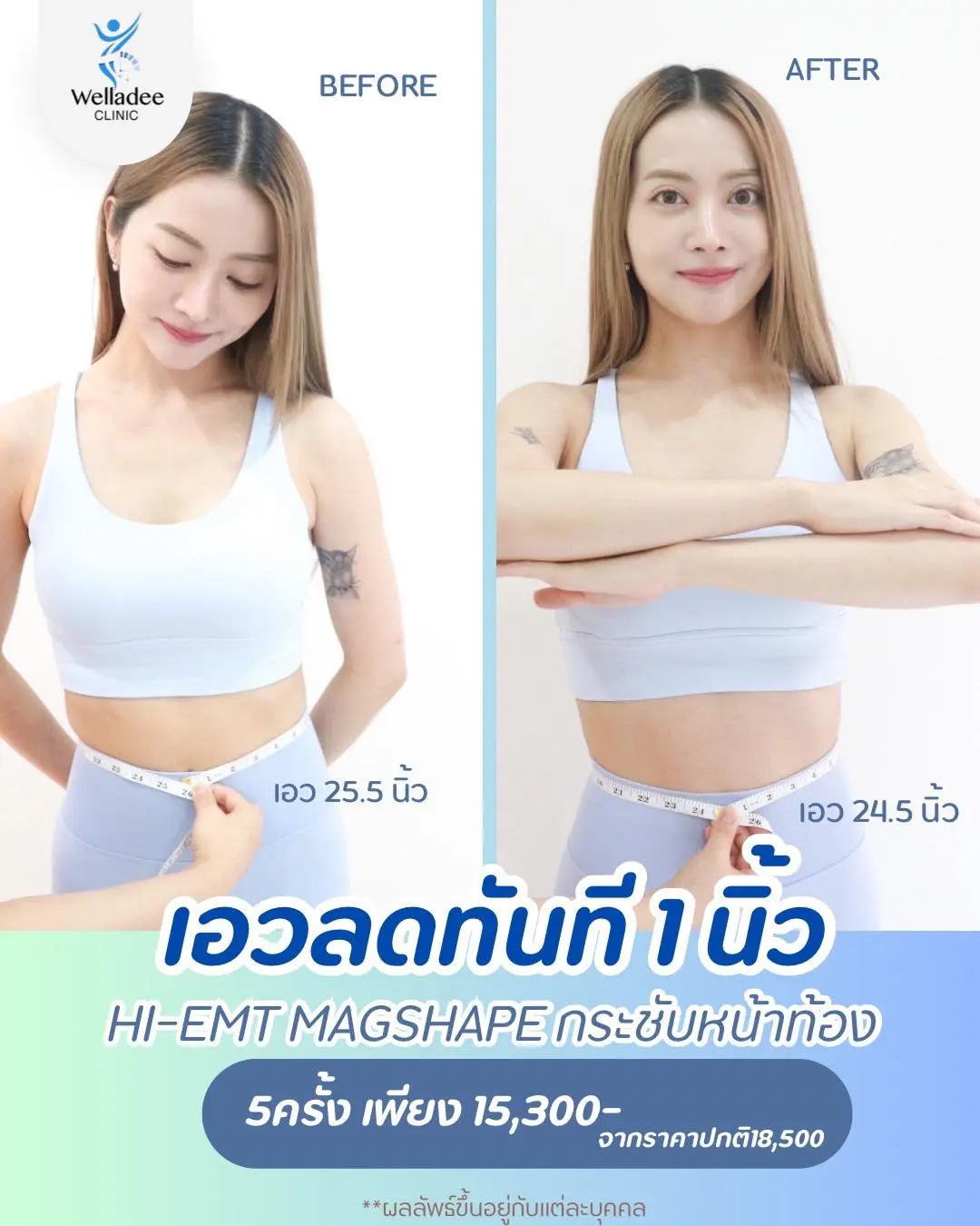 Promotion 5